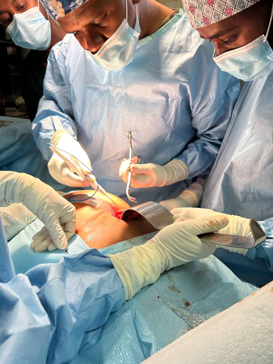 Surgeon reviewing liver imaging in Harar, Ethiopia, before deciding on a treatment plan
